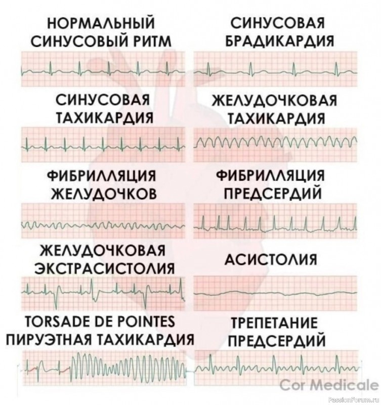 Наше здоровье. Что означает электрокардиограмма
