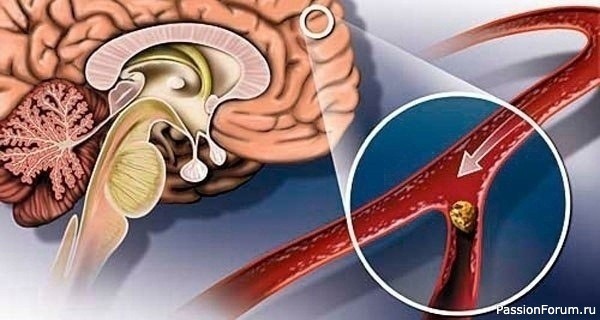 Улучшаем кровообращение народными средствами