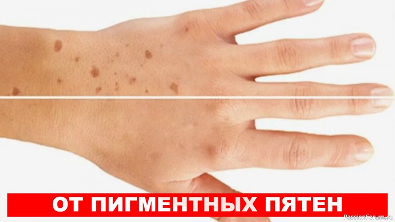 Бабушкин СПОСОБ от пигментных пятен, проверено работает