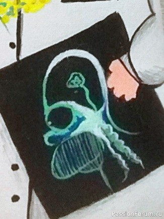 Рентген Гомера Симпсона ( Подарок для рентгенолога )