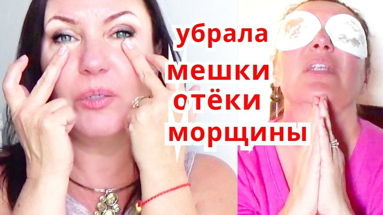 Как убрать мешки под глазами ? ЧУДО МАСКА ДЛЯ КОЖИ ВОКРУГ ГЛАЗ от малярных мешков,отёков и морщин